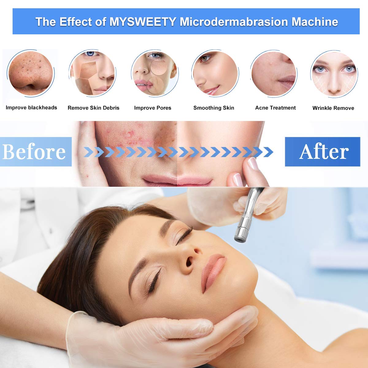 Diamond Microdermabrasion Machine, MYSWEETY 65-68cmHg Suction Power Professional Diamond Equipment for Home Use Skin Peeling Skin Lift Tighten Beauty Machine : Beauty