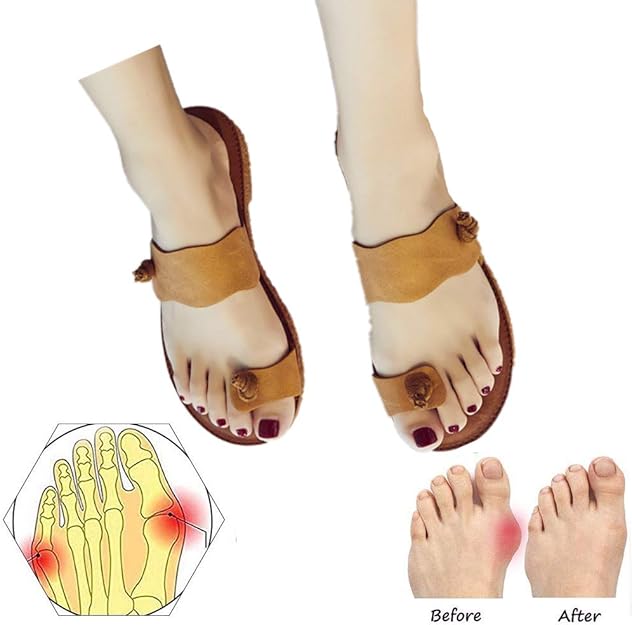 YXH Summer Travel Beach Slippers Big Toe Correction Sandals with Arch