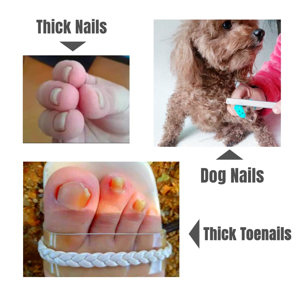 2 Pieces Toe Nail Files for Thick Nails,Stainless Steel, 4 Sides for Men Seniors & Dogs
