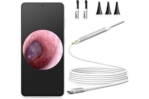 Mini Otoscope-USB Ear Camera, Anykit 3.9 mm Diameter Visual Digital Otoscope with 6 LED Lights and Earwax Removal Tool for Adult & Children, Compatiable with Phone & Tablet