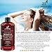 Art Naturals 2 Pack - Scalp18 Coal Tar Therapeutic Anti Dandruff Shampoo 16 oz - Helps clear symptoms of Psoriasis, Eczema, Itchy Scalp & Dandruff - Made in USA with Natural & Organic Ingredients