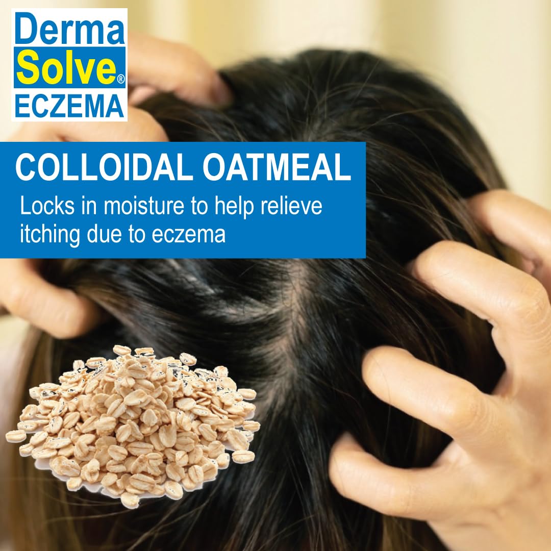 Dermasolve Eczema Relief Shampoo - Flare Control Scalp & Dandruff Free Therapy That Protects, Moisturizes, and Repairs Skin for Kids & Adults - Steroid Free (2-Pack)