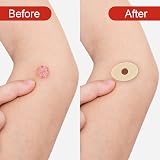 jeufun 60pcs Corn Cushions Self Adhesive Toe Pads Foot Care Callus Oval view 4