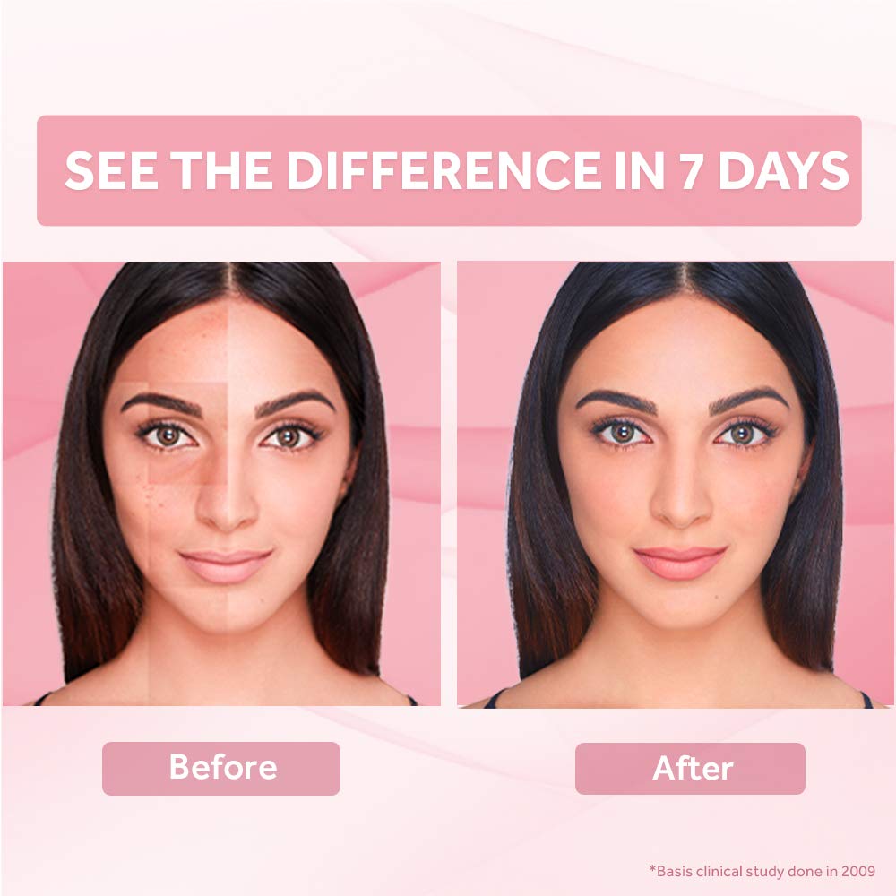 anti spot fairness cream