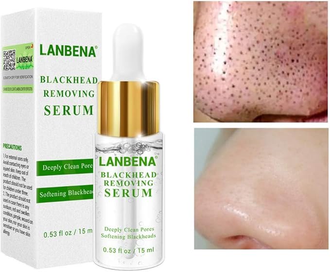 serum for blackheads
