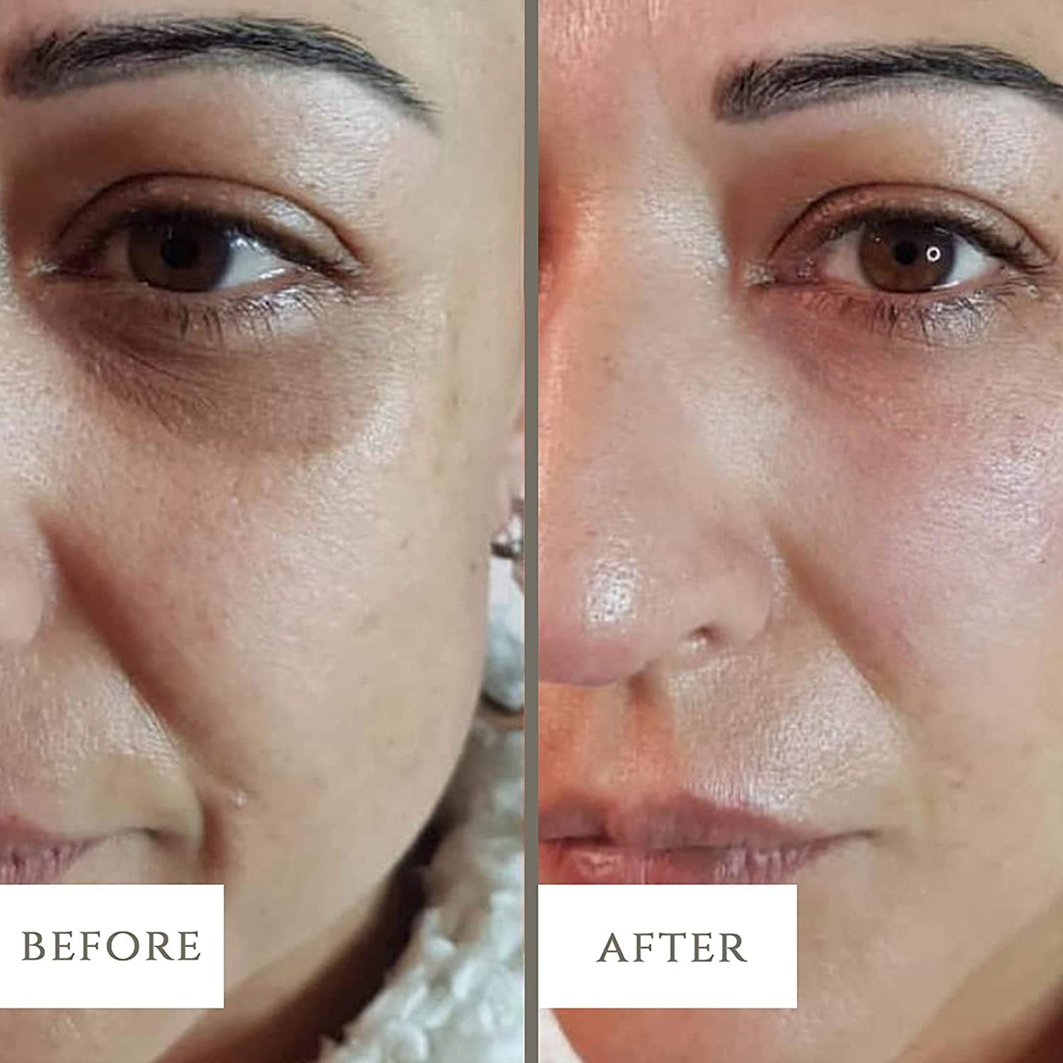 LuxeBiotics Under Eyes Dark Circle,Eye Puffiness,Eye Bags, Treatment Remover NATURAL serum: Beauty