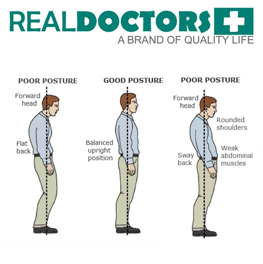 Spondylolisthesis symptoms and treatment picture