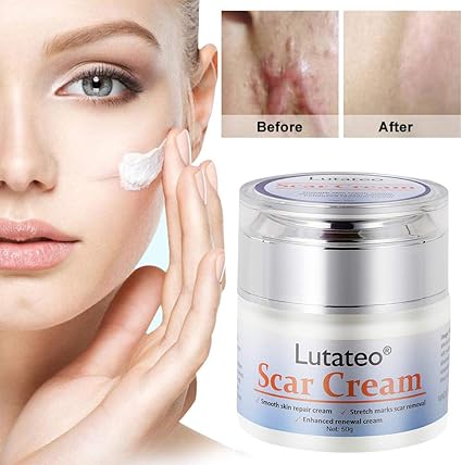 face burned from acne cream