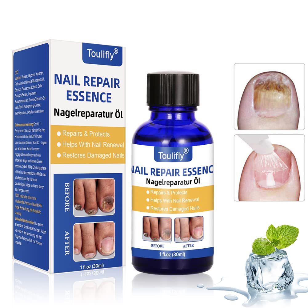 Fungus Stop, Natural Toenail Fungus Treatment, Nail Fungus Treatment, Strong Anti-Fungal Toenail Solution, Nail , Nail Treatment Essence, Fungi Foot and Toe Medication, Safe and Effective