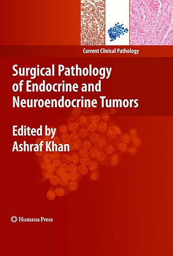 Download Surgical Pathology of Endocrine and Neuroendocrine Tumors (Current Clinical Pathology) (English Edition) PDF
