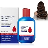 Viuvoiul Nipori Shampoo Anti,Nipori Dandruff Hair Care Shampoo - Oil Control Refreshing Cleansing,for Men and Women (120ML)