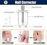 BQMEZRNUS Ingrown Toenail Treatment Kit with Corrector Strips Patches view 3