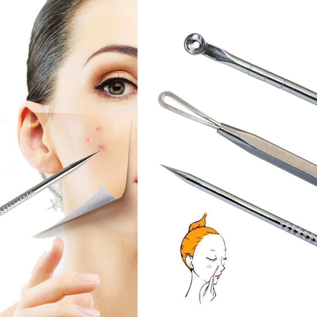 pimple zapper amazon