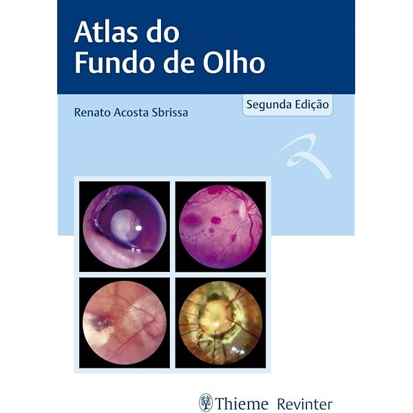 Atlas de Oftalmologia | Amazon.com.br