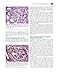 Heptinstall's Pathology of the Kidney