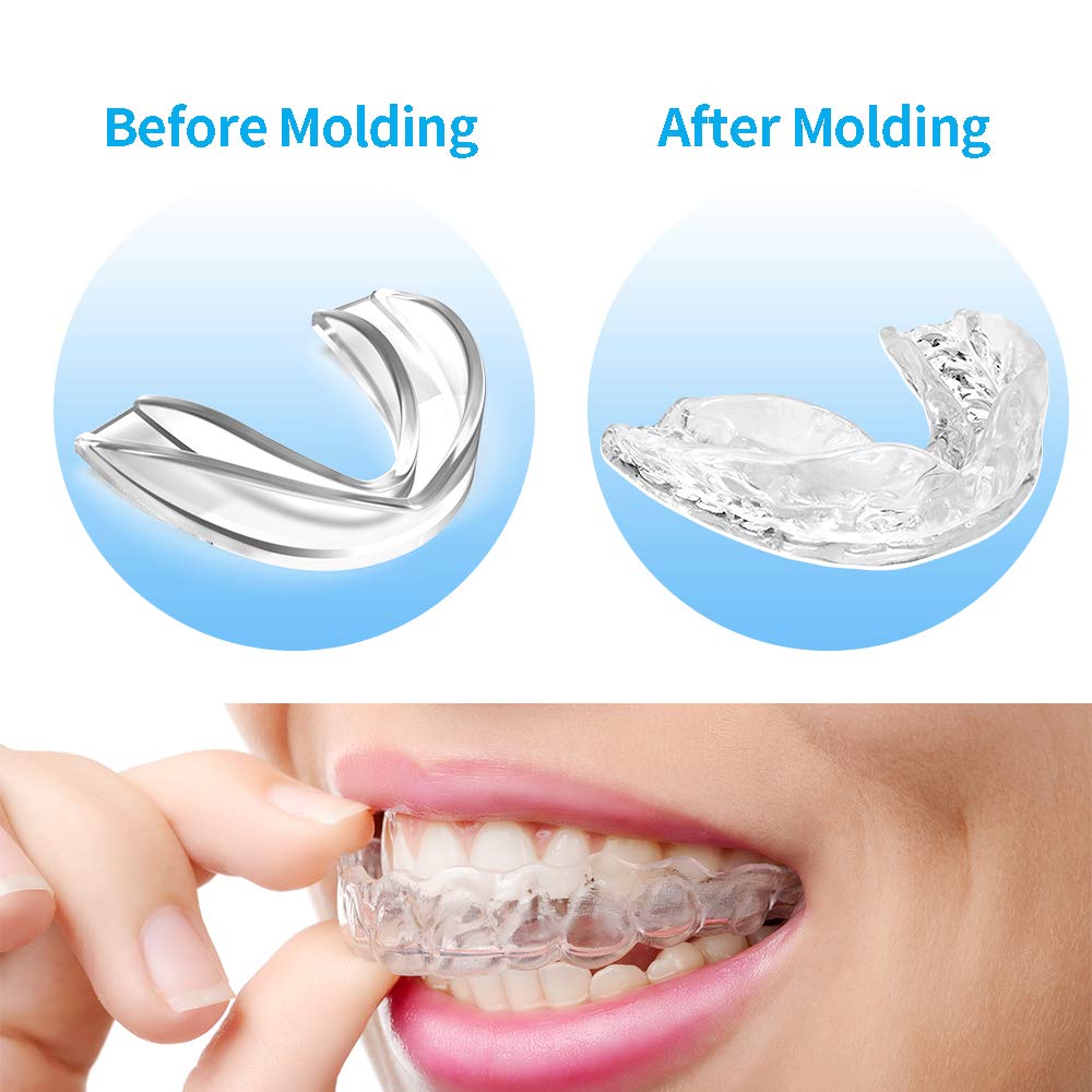 PHOEBE Mouth Guard for Grinding Teeth Night Guards for Teeth Grinding Mouldable Tooth Bite Guard Stop Teeth Grinding Clenching Eliminates Bruxism, TMJ -3 Sizes, 6 Pieces : Beauty