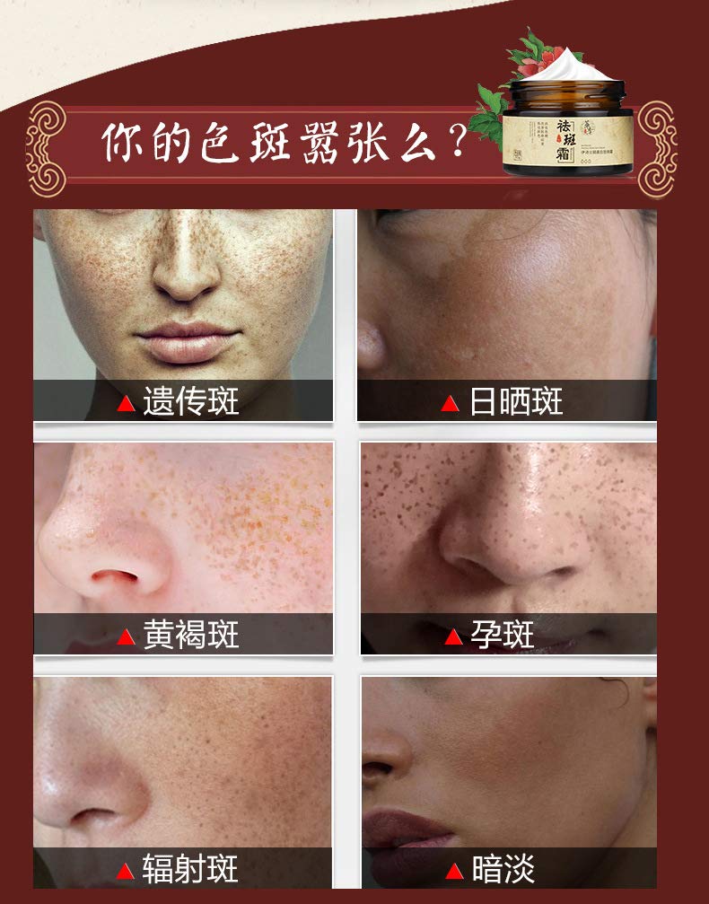chinese dark spot remover