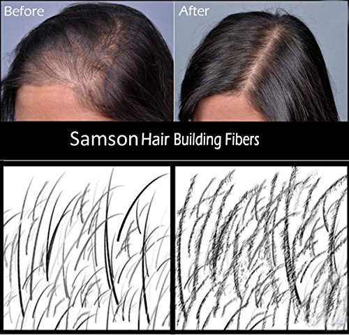 Hair Fibers by Samson Best Hair Loss Concealer Building Fibers Containers & Refills for all brand names Made in USA (Medium Brown Combo-Saver)
