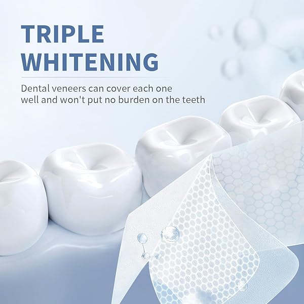 SOMALL 9D TEETH WHITENING STRIPS – 【NEWEST 2024】 PROFESSIONAL DENTAL FORMULA – ENAMEL SAFE WHITENING WITHOUT THE SENSITIVITY – 14 TREATMENTS WITH 28 STRIPS + MOUTHWASH GIVEN*14