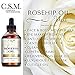 C.S.M. ROSEHIP OIL for Smooth, Healthy, Glowing Skin - 100% ORGANIC and Cold Pressed Essential Oil for Dry Skin and Itchy Scalp Relief - Natural Anti-Aging Facial Serum for Wrinkles Fine Lines (4 oz)