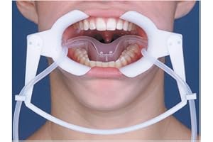 SINO DENTAL GROUP Dental Oral Dry Field System Nola Retractor,Orthodontic Teeth Whitening Cheek Retractor,Autoclavable Dental Mouth Opener,Disposable Dental Lip Cheek Retractor for Mouthguard L