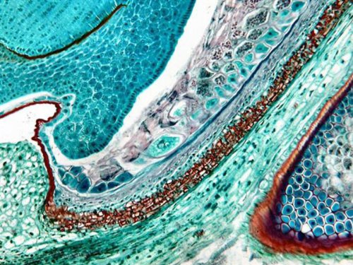 AmScope-M150C-I-40X-1000X-All-Metal-Optical-Glass-Lenses-Cordless-LED-Student-Biological-Compound-Microscope