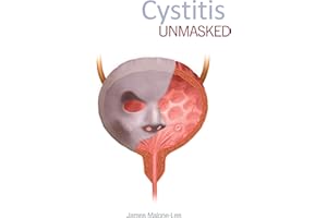 Cystitis Unmasked