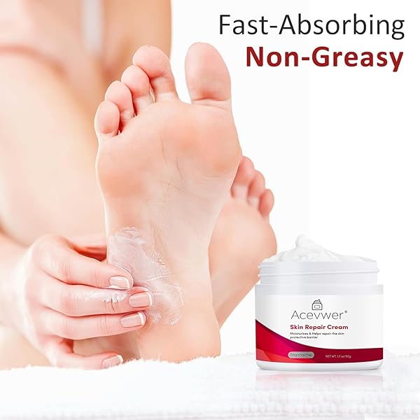 TXOGUJ FOOT CREAM FOR DRY DRACKED HEELS AND FEET FOOT CARE FAST-ACTING ANTI-ITCH TREATMENT MOISTURIZE FOR SKIN IRRITATION,ITCHY SKIN – 1.7OZ