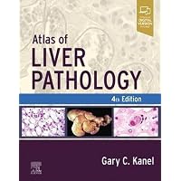 MacSween's Pathology of the Liver: 9780702082283: Medicine