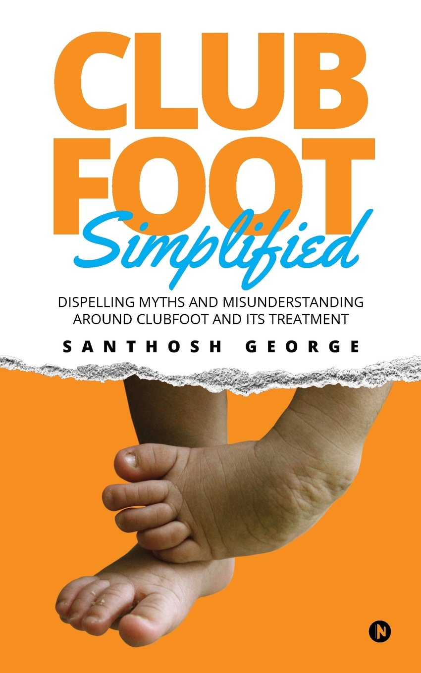 Clubfoot Simplified Dispelling Myths And Misunderstanding Around Clubfoot And Its Treatment George Santhosh Books Amazon Ca