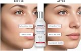 Novaclear RETINOL Rejuvenating Facial Toner Mature Skin Lactic Acid Arctium view 4