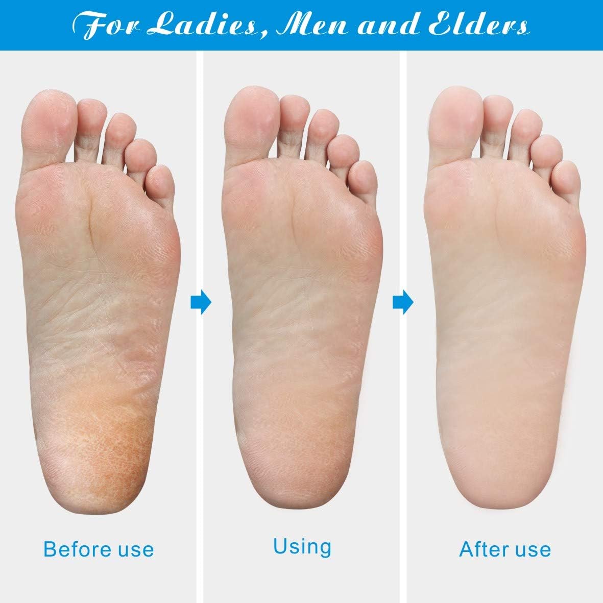 Colossal Pedicure Rasp Foot File, Professional Foot Care Pedicure Stainless Steel File to Removes Hard Skin, Can Be Used On Both Dry and Wet Feet: Health & Personal Care