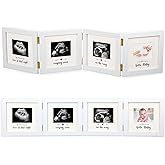 Beeveer Sonogram Picture Frame Quadruple Ultrasound Picture Frame 4 Folding Pregnancy Keepsake Photo for Pregnancy Announcements First Time to Be Dad Mom Gifts Gender Nursery Decor(White)