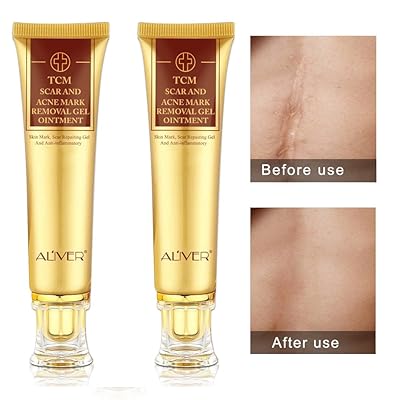 Buy 2 pack Aliver TCM Scar and Acne 