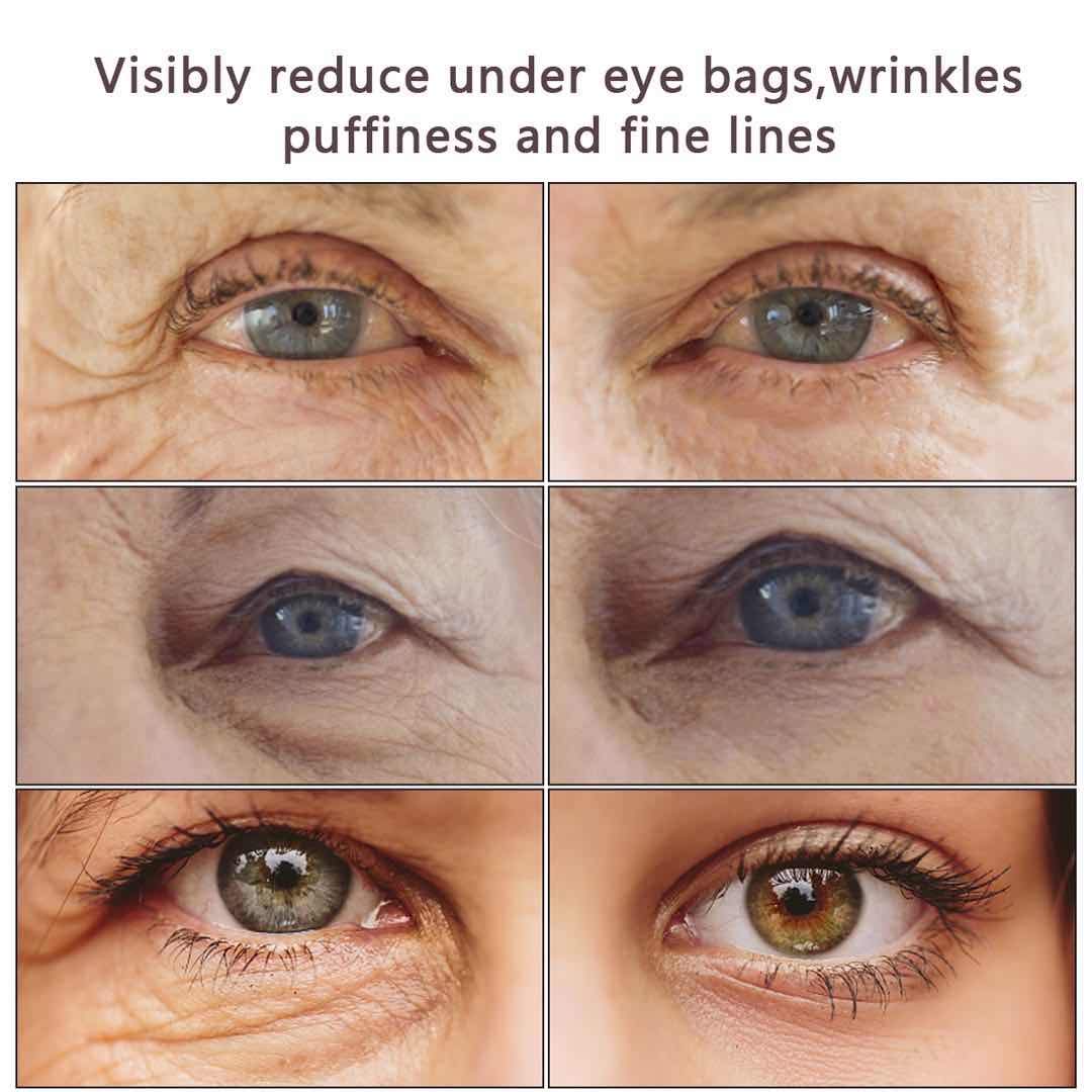 reduce under eye wrinkles