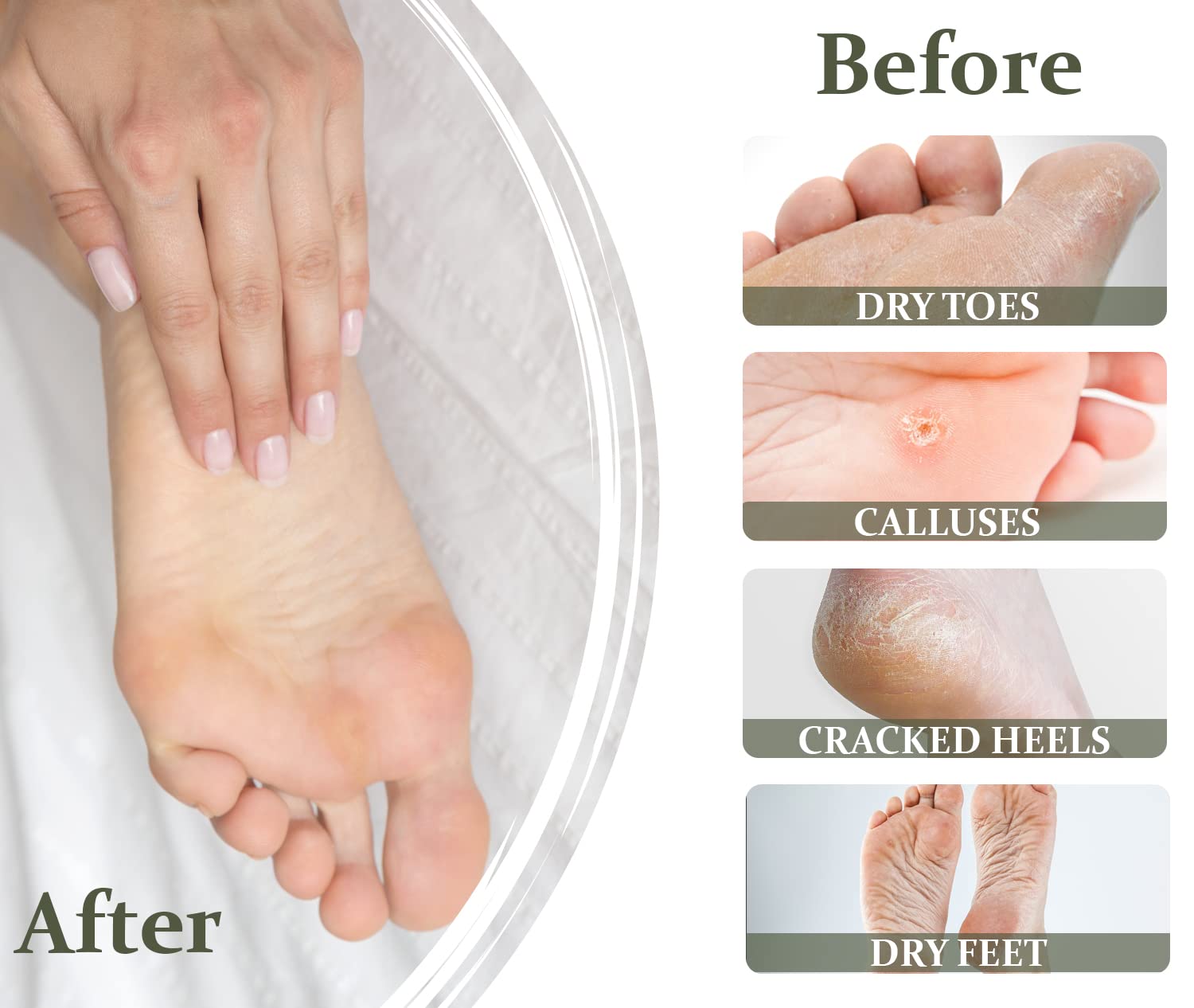 VERONA PRODUCTS PROFESSIONAL Urea Foot Cream for Dry Cracked Feet with Olive Oil - Athletes Foot Treatment Cooling Effect - Nourishing Foot Repair Cream