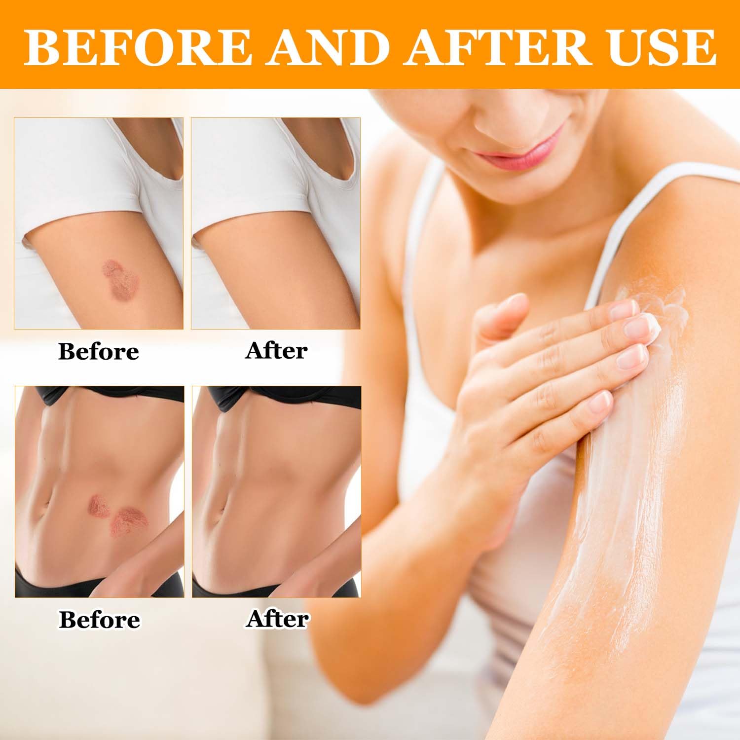 3 Bottle Bee Venom Cream, New Bee Venom Skin Cream, Professional Bee Venom Correcting Cream for All Skin Types