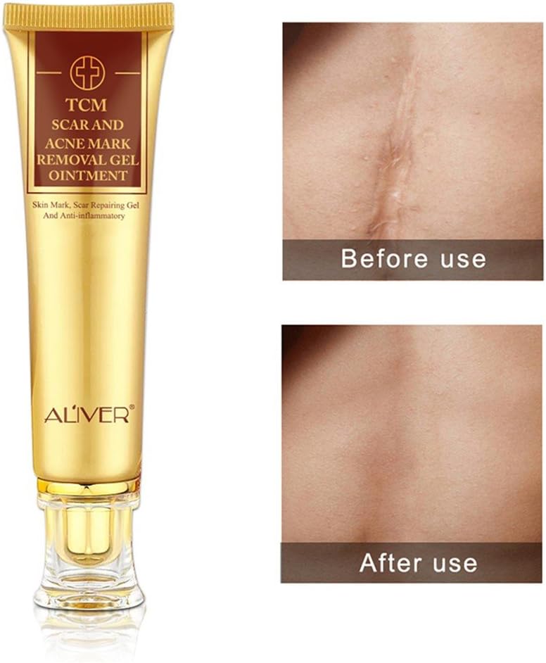 Scar Removal Cream, Acne Marks Burns Cuts Pregnancy Stretch Marks Acne Spots Skin Repair Treatment Whitening Cream for Face and Body