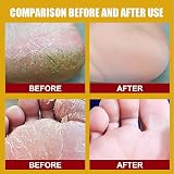 BT Beauty Foot Repair Cream Intensive Moisturizing Dry Cracked Heels Hands view 4