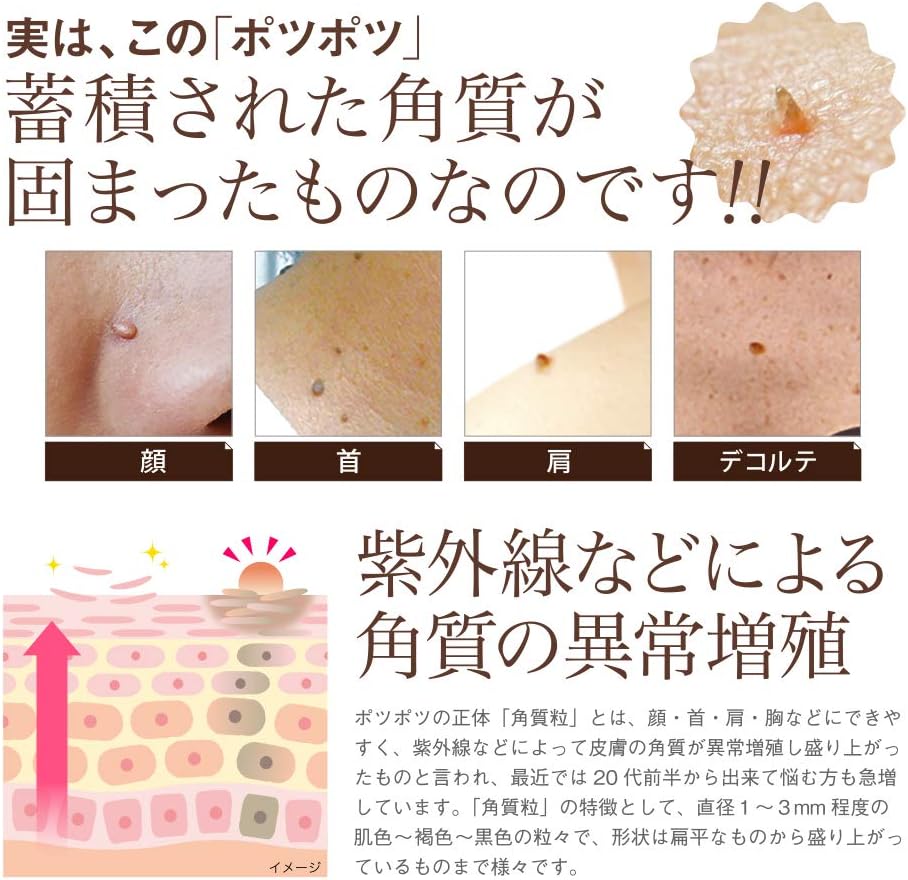 Amazon 角質粒 気になるポツポツ角質粒をケア イポケアex イポケアex サプリメント ビタミン Amazon 角質粒 気になるポツポツ角質粒をケア イポケアex イポケアex サプリメント ビタミン