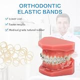 Xumann 300 Pcs Orthodontic Elastic Bands 3/16 for Braces Rabbit view 3