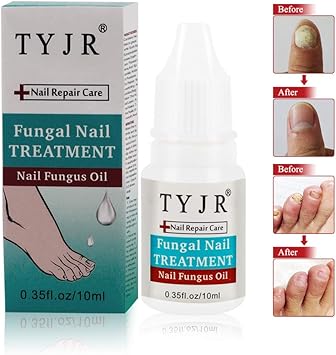 Anti Fongique Mycoses Nails Traitement Antifongique Des Ongles Champignon Champignon Solution Antifongique Contre Les Infections Fongiques Des