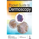 Pocket Guide to Dermoscopy