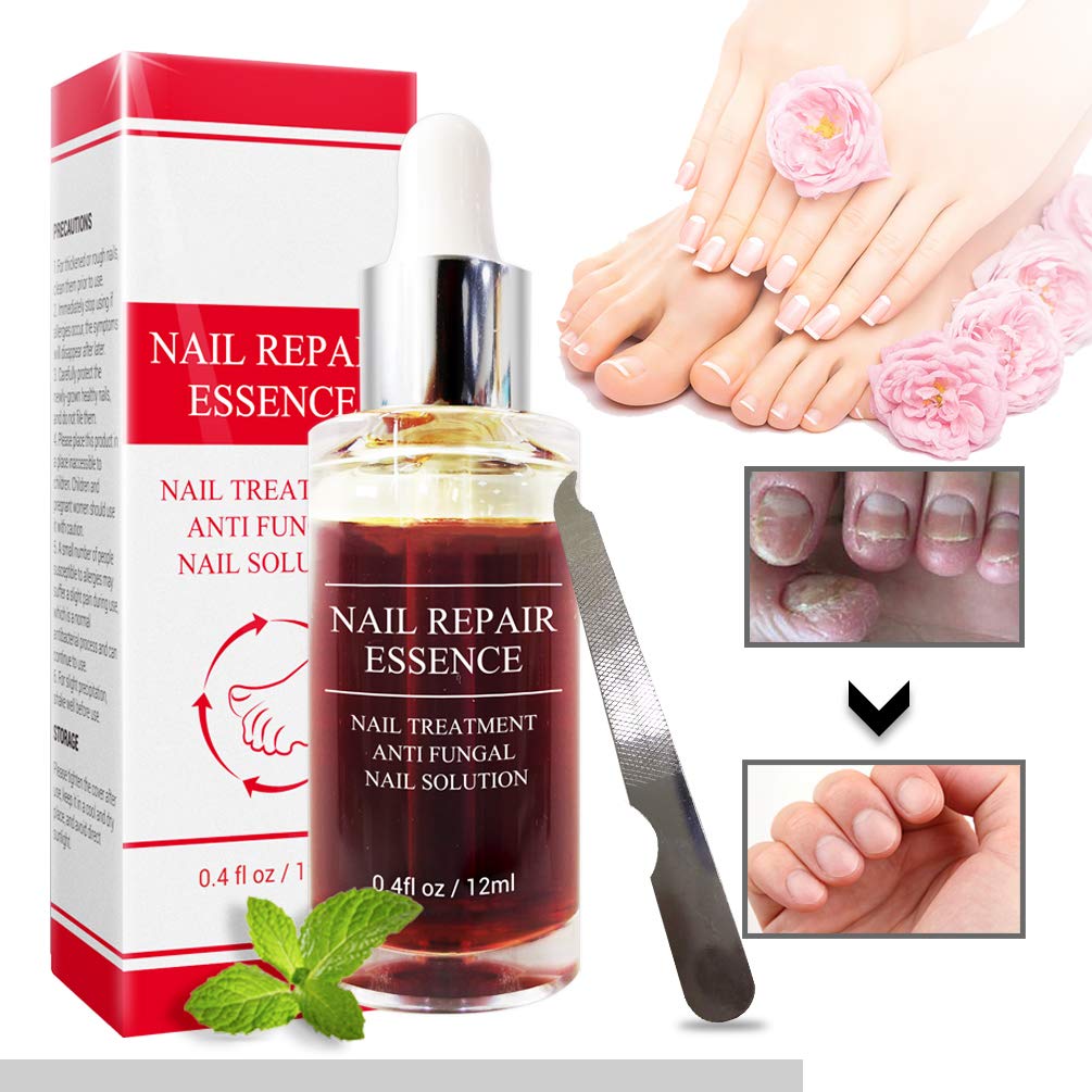 Fanmin Toenail and Nail Repair Essence, Remove Paronychia Onychomycosis Toe, Toenail and Nail Care Solution, Toenail and Nail Renewal, Fixes and Restores Discolored and Damaged Nails : Beauty