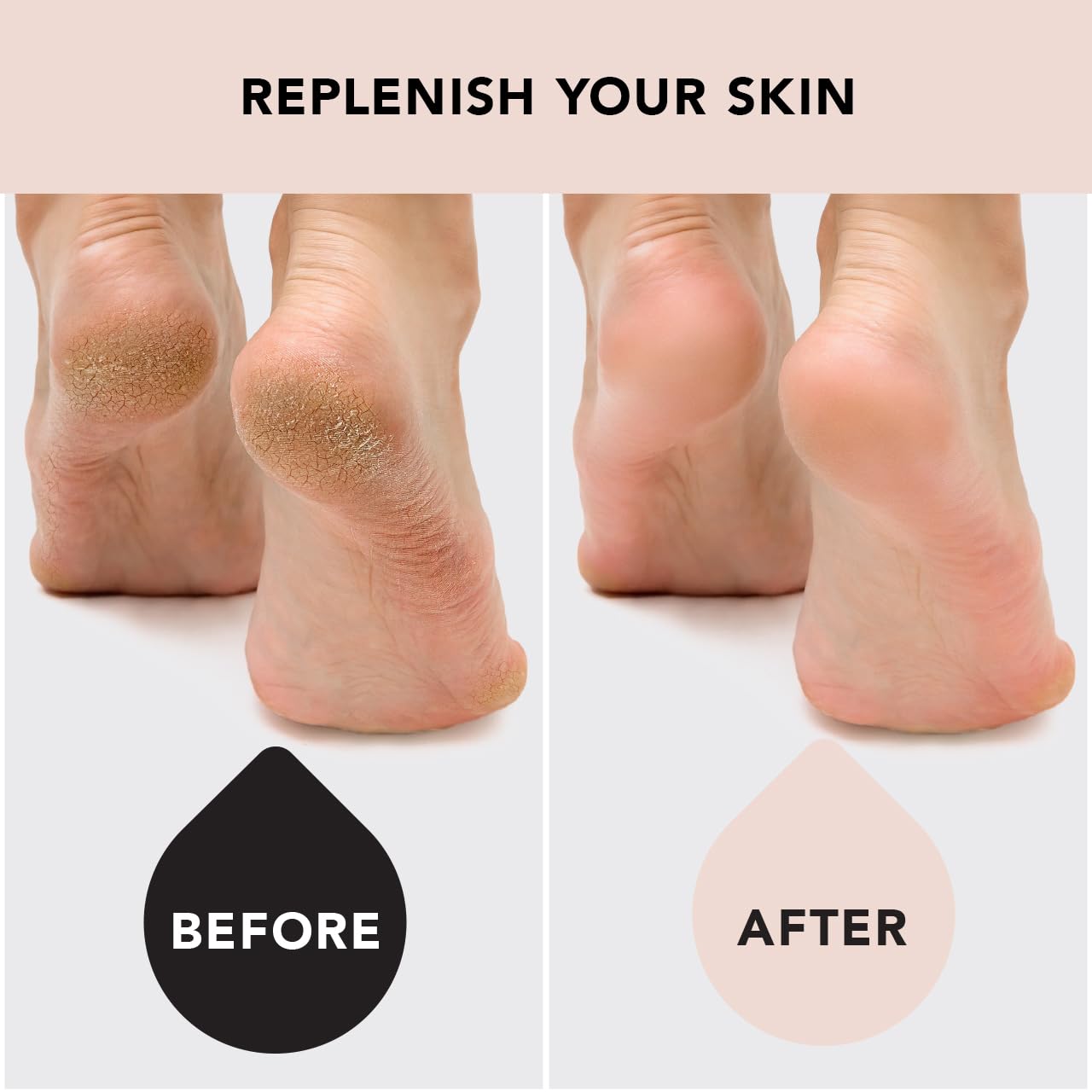 Kitsch Moisturizing Socks for Cracked Heel Treatment – Reusable Spa Socks for Women & Men with Insulated Gel Lining - Overnight Heel Socks for Dry Cracked Feet, Hydrating, Open-Toe Design - 1 Pair