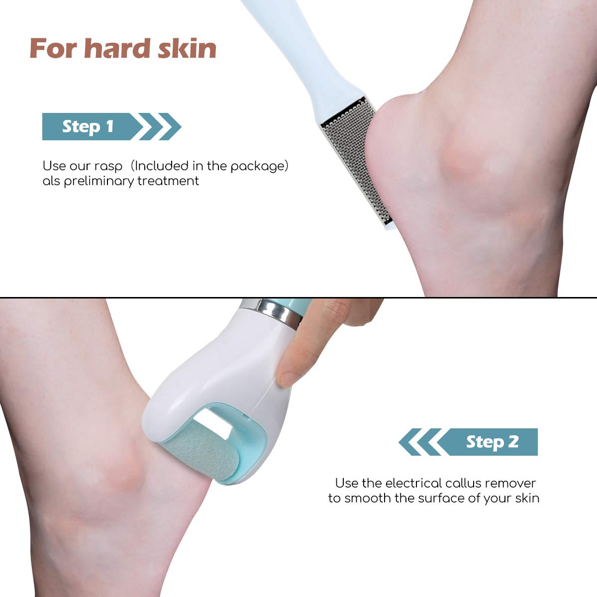 Mondeer Electronic Callus Remover, Blu-ray Disinfection Pedicure Tool, Foot Massage, 3 Rollers Included(Fine Grinding Roller/Rough Grinding Roller/ Massage Roller), Unisex, A Free Foot File Included.