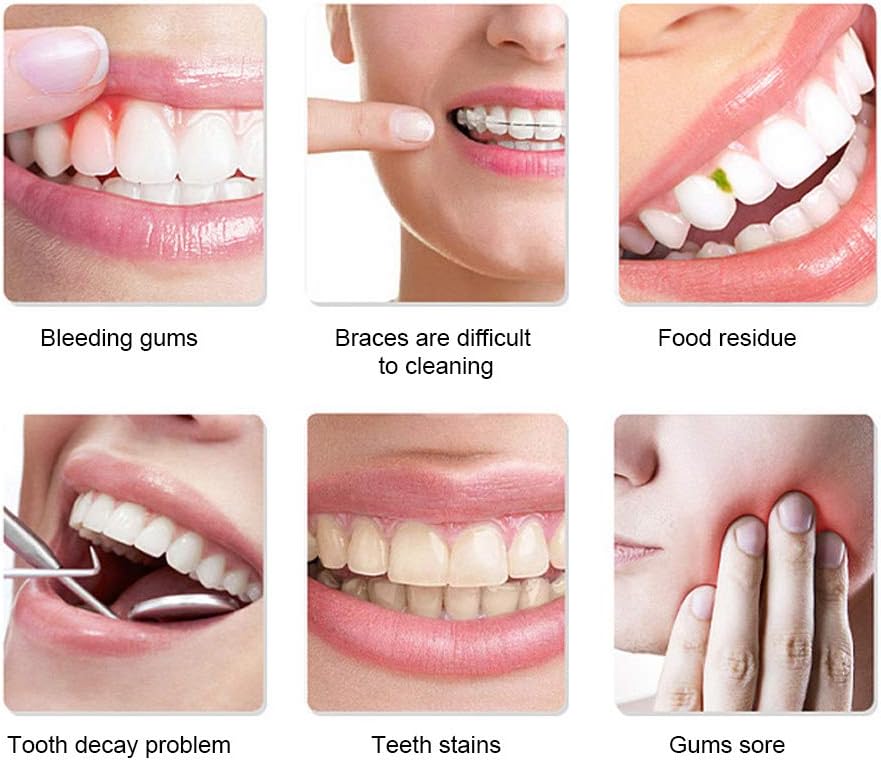 Oral Irrigator, 3 Mode Water Flosser, Interdental Space Cleaner Professional Water Flosser For At Home For Healthier Gums For Thorough Cleaning And Massage Of The Gums - Image 3