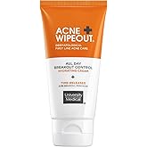 University Medical Acne Wipeout All Day Breakout Control Hydrating Acne Cream - Time Released All Day Clearing Micronized 2.5% Benzoyl Peroxide Treatment, Hydrating, Minimal Dryness, 2 fl oz