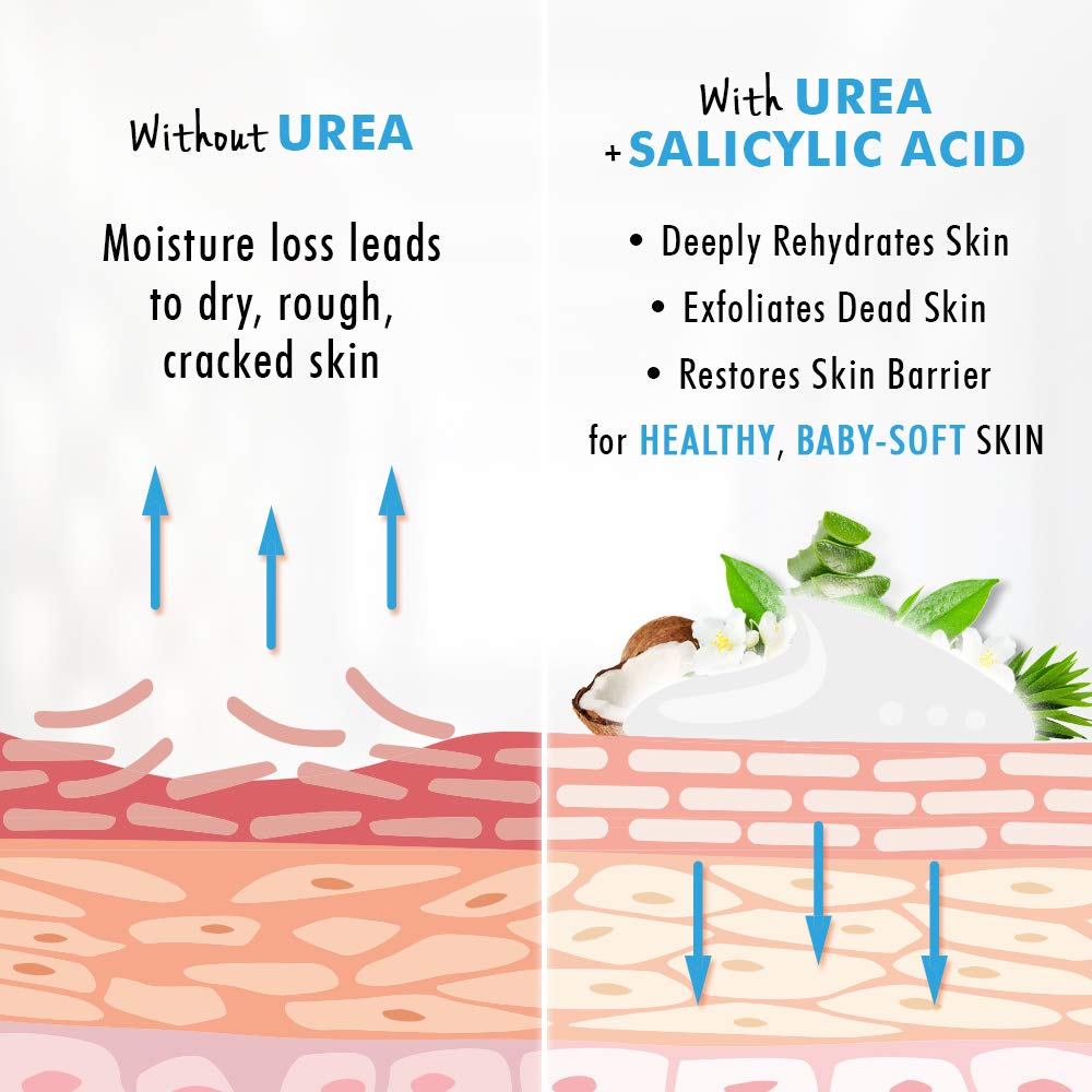 Urea Cream 40% Plus Salicylic Acid 4.6 Oz, Callus Remover Hand Cream Foot Cream For Dry Cracked Feet, Hands, Heels, Elbows, Nails, Knees, Intensive Moisturizes & Softens Skin, Exfoliates Dead Skin : Beauty