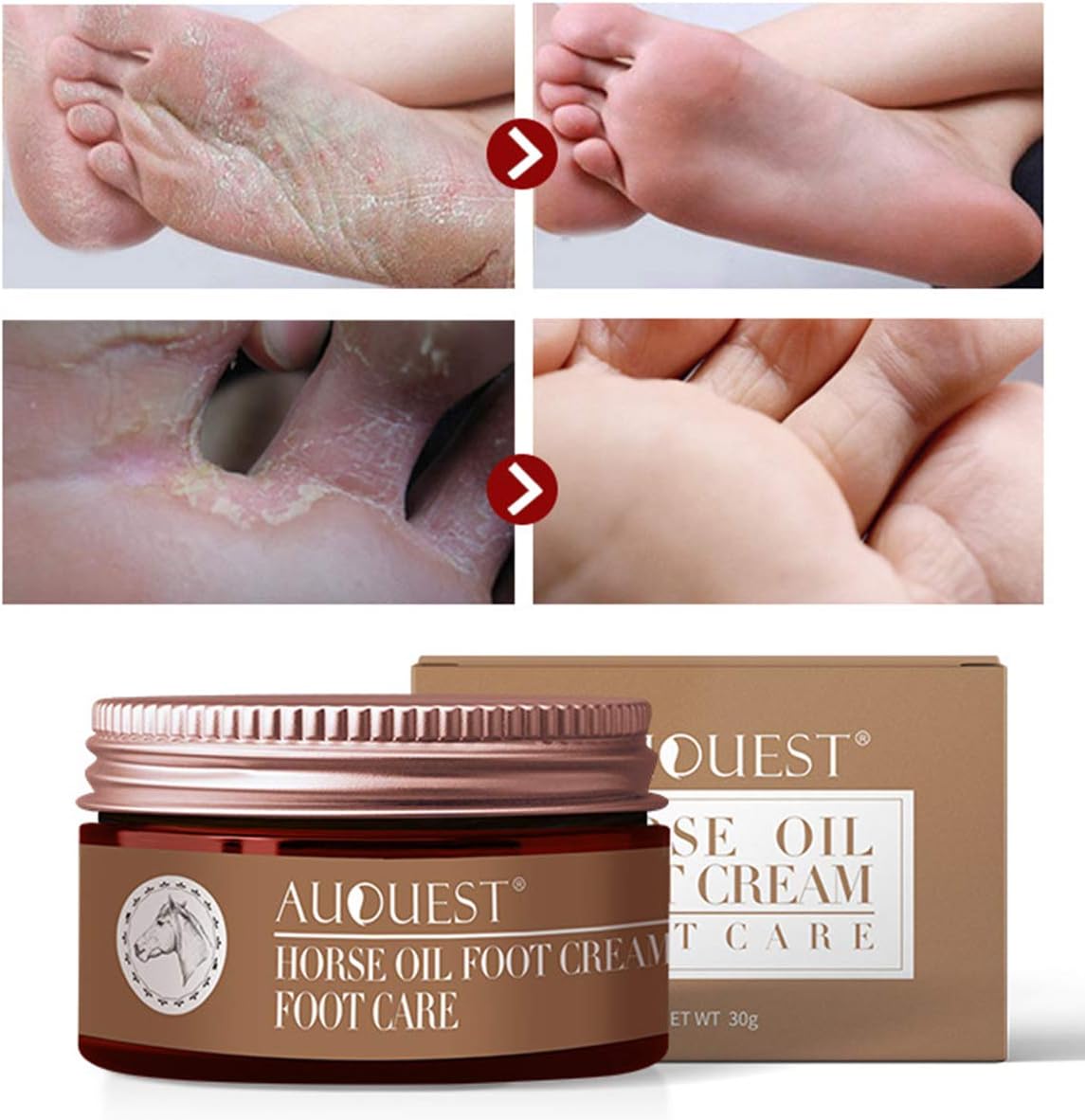 AJUMKER Horse Oil Foot Cream Foot Care Cream Moisturizing Itch Blisters Repair Anti-chapping Smoothing Anti-fungal Peeling Feet Care